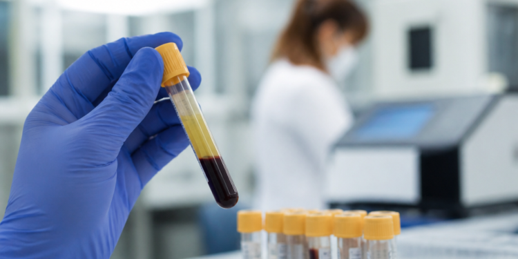 Cuáles son las nuevas formas de medir el colesterol y cómo interpretar los resultados